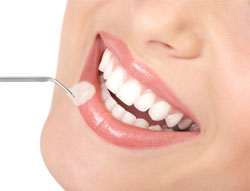 Conditions That Qualify a Patient for Dental Veneers